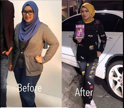 Ubat Kuruskan Badan: Choco Fit