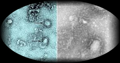 coronavirus_ COVID-19 vaccine 2021