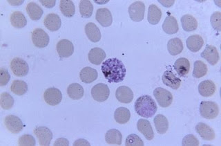 Biologia Total Protozoo Esporozoario Plasmodium Malariae