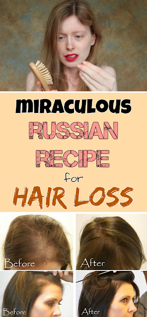 Miraculous Russian recipe for hair loss