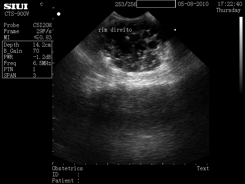 PetScan - Ultrassonografia Veterinária: PKD - Doença Renal Policistica