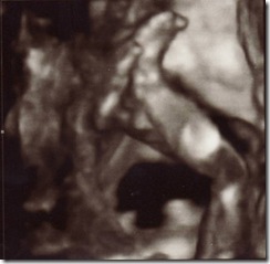 Feet at 20 Weeks