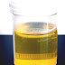 Urine Therapy - Athletes Foot Cure Urine