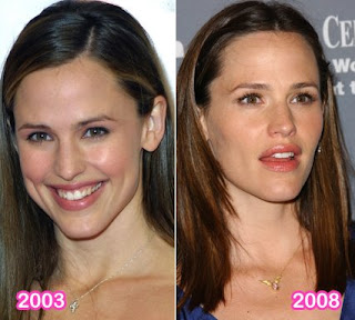 jennifer-garner-lips.jpg