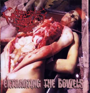 Corrosive Gastric Hemorrage - Extracting the bowels (2011)