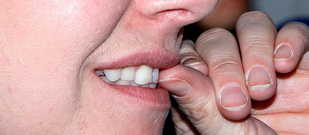 Las causas de morderse las uñas y sus consecuencias dentales