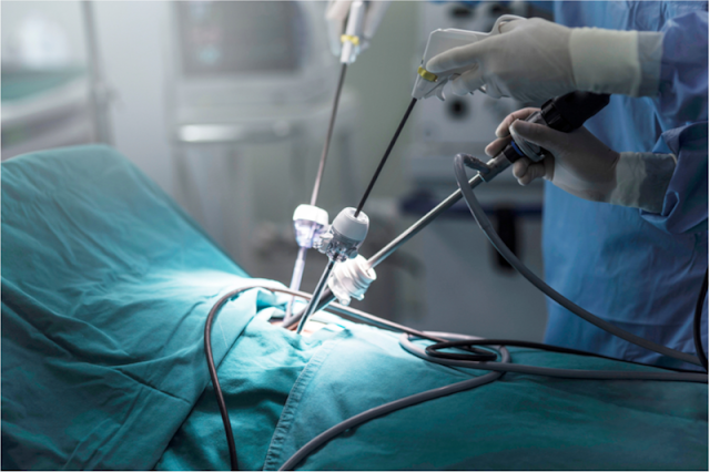 Laparoscopic Power Morcellators Market