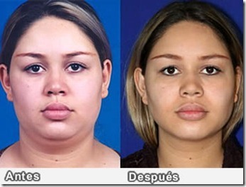 Como Adelgazar Rapido la Cara_thumb[1]