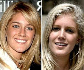 heidi montag antes y despues