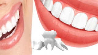 Tighten Loose Teeth With These Home Remedies