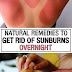 Natural Remedies to Get Rid of Sunburns Overnight