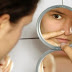 Tips Cara Menghilangkan Komedo di Wajah dan Hidung