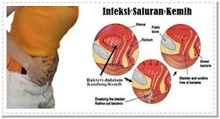 Obat Infeksi Saluran Kencing Herbal De Nature