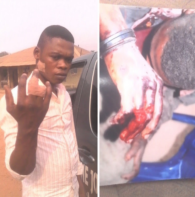 Horror As Chinese Man Cuts Off Nigerian Man’s Finger For Not Putting On The Generator Quickly In Cross River