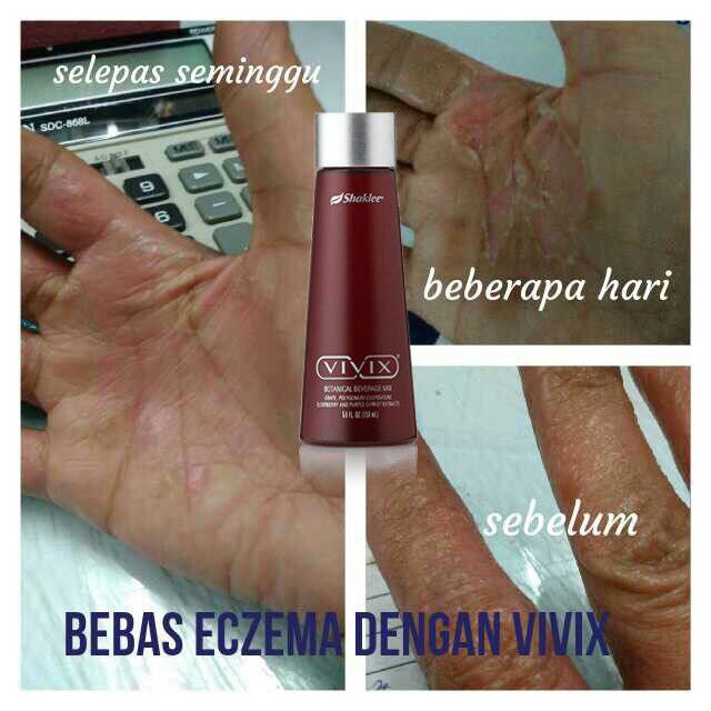 Vivix Shaklee - Keistimewaan, Fungsi, Ramuan, Manfaat Dan 