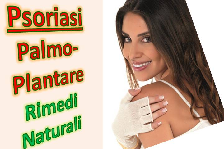 psoriasi plantare cure