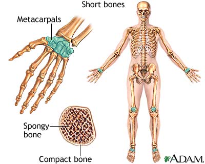 gambar penyakit tulang osteoporosis