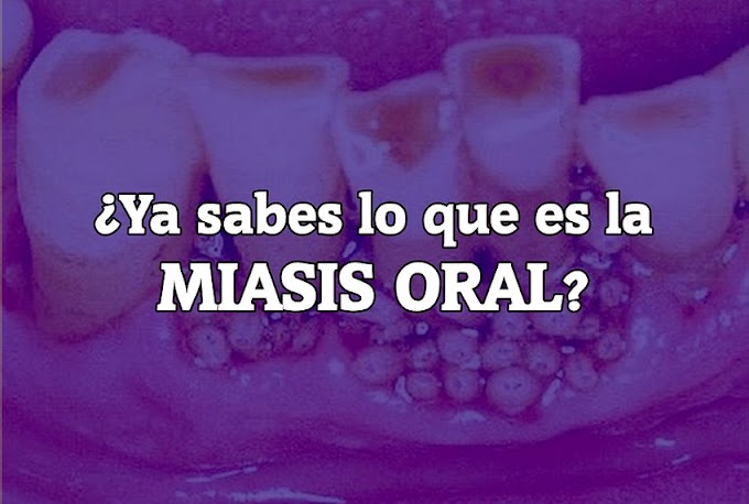 ¿Ya sabes lo que es la MIASIS ORAL? 