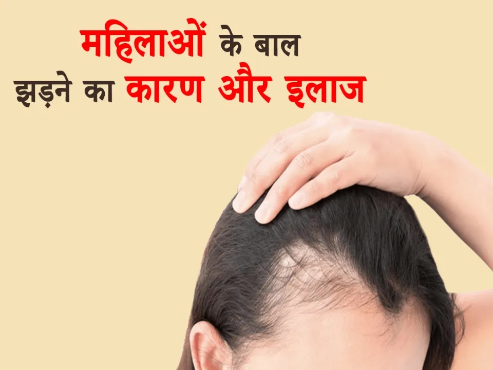Hair Loss Treatment for Women in Hindi