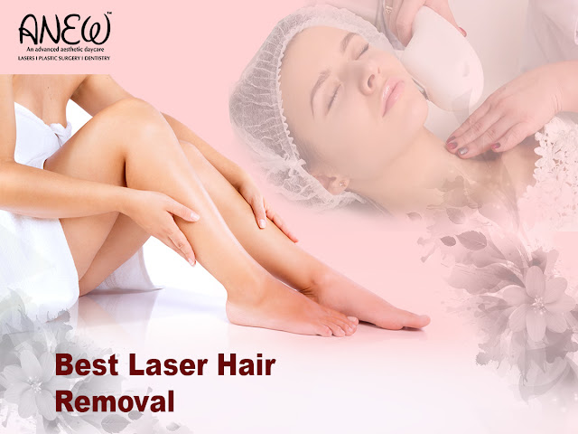 best laser hair removal in Bangalore