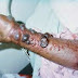 Ebola Heats Port-Harcourt City, Doctor Involve.