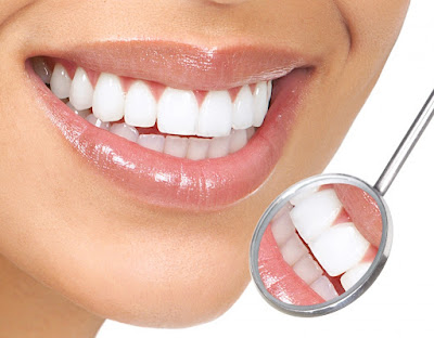 Quy trình bọc răng sứ cho răng vẩu