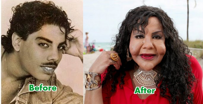 Rajee Narinesingh before and after photos