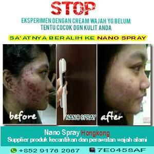 Toko Onlines Obat Jerawat Nano Spray Hong kong