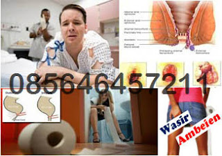 Harga AmbeJOSS Obat Wasir Apotik Herbal Online