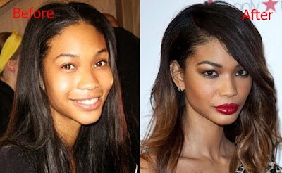 Rumor Operasi Hidung Chanel Iman