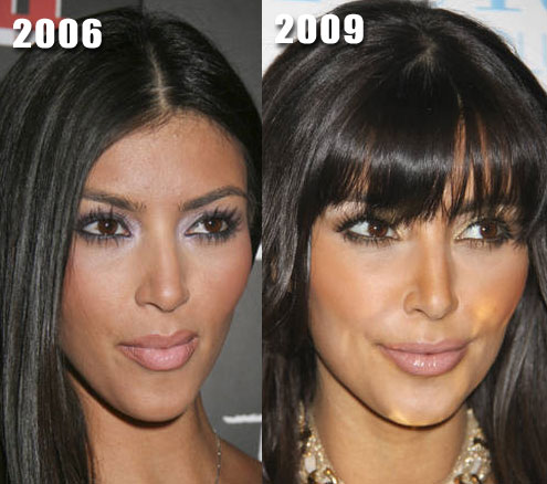 nicki minaj before and after pictures of plastic surgery. Kim Kardashian Plastic Surgery
