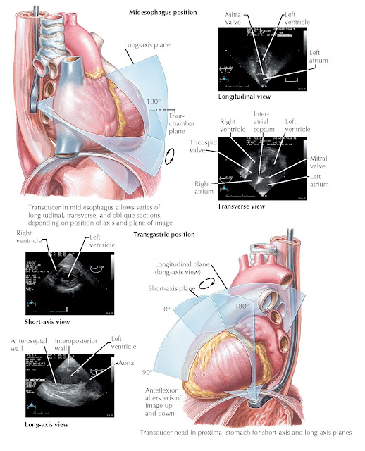 Transesophageal echocardiography