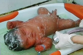 Chinese Woman Gives Birth to 15.4-pound Baby