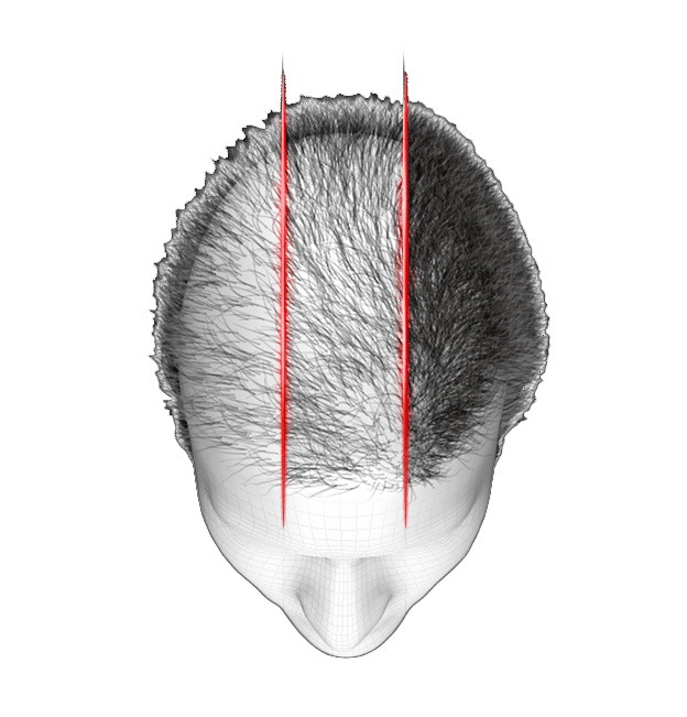 hair loss blocker funciona?