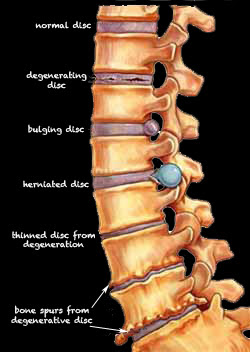  Left Bilateral Level(s)_____ Sciatic Nerve Block  Document Viewer