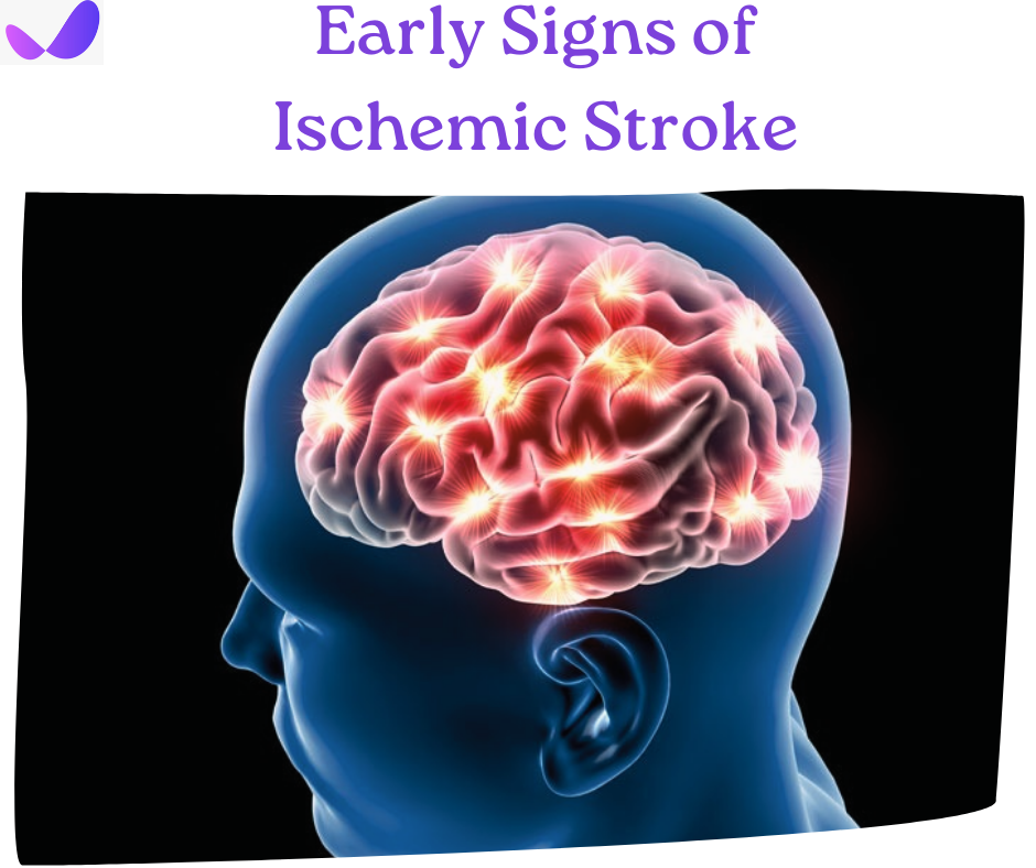 Early Signs of Ischemic Stroke