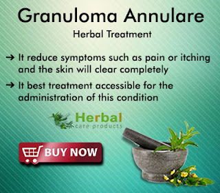 Herbal Supplements for Granuloma Annulare