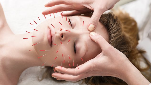 Chiropractors and Acupuncture