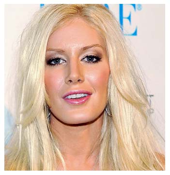 heidi montag after surgery 2010. Heidi Montag Before After