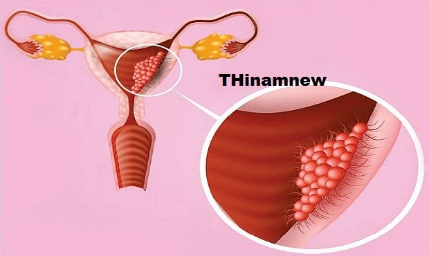 பெண்கள் கருத்தரிப்பதில் தாமதம் ஏன்?