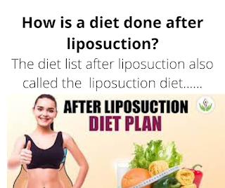 How is a diet done after liposuction?