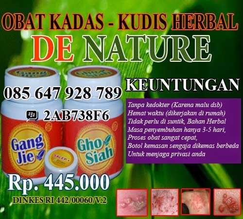 lengkuas obat kadas