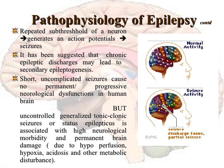 Image result for epilepsy