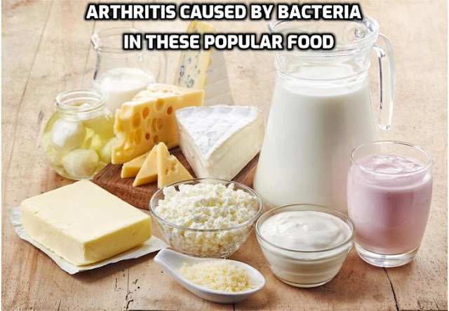 Completely Reverse Your Arthritis - Arthritis Caused By Bacteria in These Popular Foods. A new study from the University of Central Florida published in the journal Frontiers in Cellular and Infection Microbiology reveals amazing news for arthritis patients. It can lead to a complete cure for your disease by cutting out just a couple of food items – maybe even temporarily.