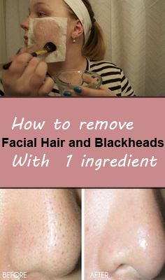 Homemade mask to pull out blackheads