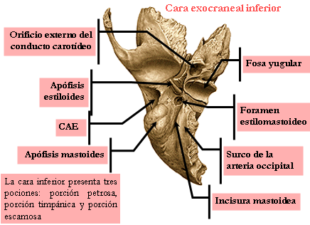 Exocraneal temporal bone lateral face