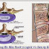 Khi bạn bị đau lưng hãy coi chừng thoát vị đĩa đệm