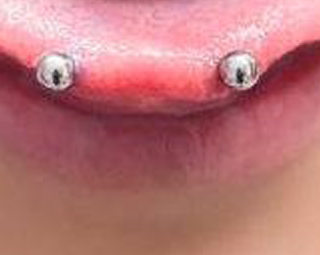 Snake Eyes Piercing Pros and Cons