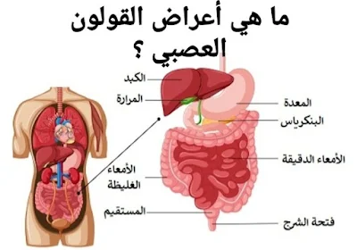 ما هي أعراض القولون العصبي ؟
