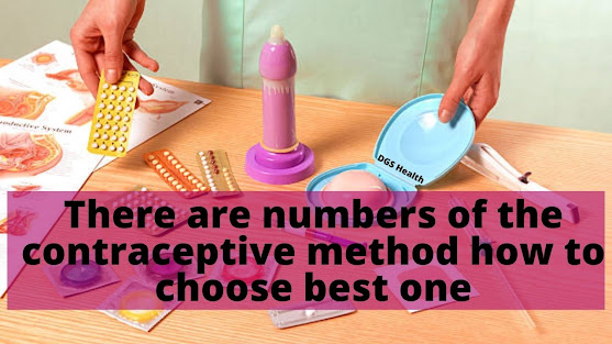 various methods of contraceptive for female